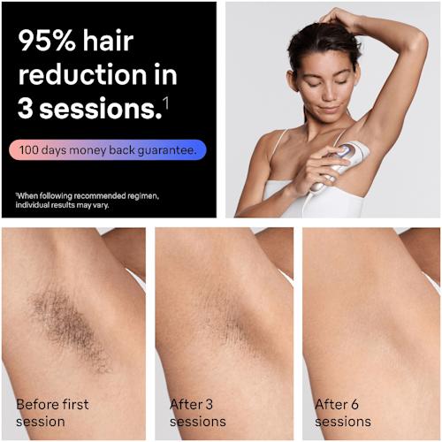 Braun Smart Silk expert Pro 7 PL7211 IPL-karvanpoistolaite